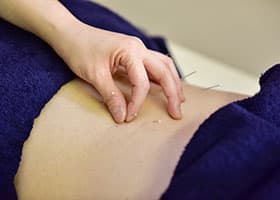 鍼コンディショニング